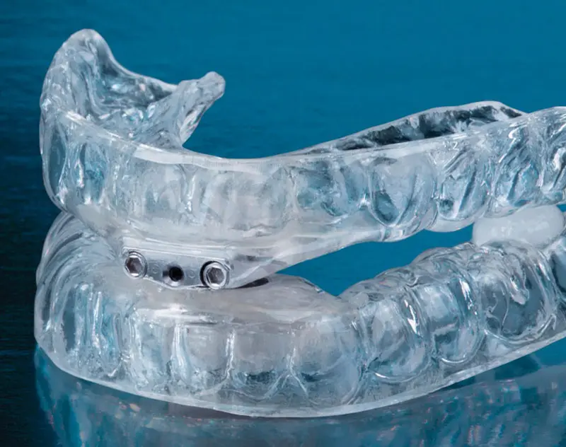 CPAP alternative oral appliance | Sleep Apnea Treatment | Clio, MI