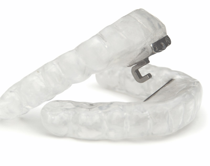 CPAP alternative oral appliance | Sleep Apnea Treatment | Clio, MI